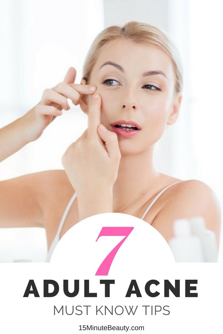 Tutoriel sur les soins de la peau Les meilleurs conseils pour traiter l acné adulte que vous n